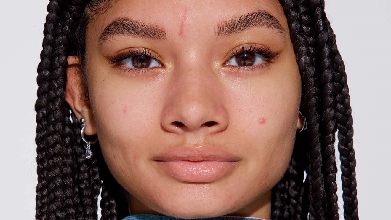 Maybelline Fit Me Microscopic concealer model before